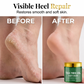 🌿✨ Crème pour les Pieds à l'Huile d'Arbre à Thé – Talons Secs & Craquelés 🦶💧